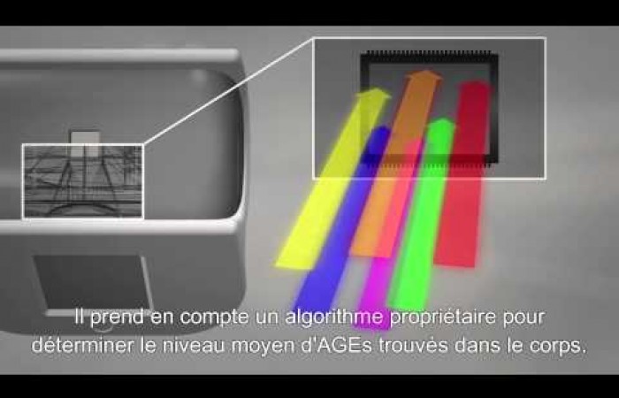 Le scanner TruAge et son fonctionnement (sous-titré en français)